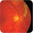 Clinical Neuro-Ophthalmology