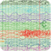 Clinical Neurophysiology  at BWH